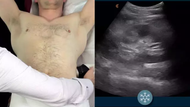 Ultrasound Of The Kidneys - Indications, Preparation For The Procedure, How The Study Is Carried Out