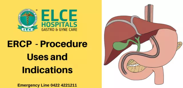 Gastroscopy - Preparation, Indications, Contraindications