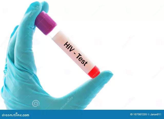 Blood Test - Methods, Indications, Results, HIV Test