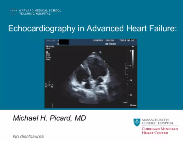 Echocardiography Of The Heart - Indications, Decoding