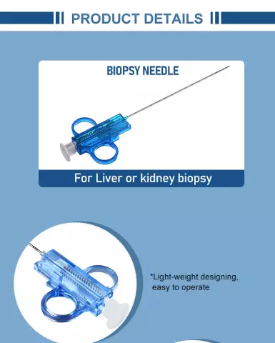 Cervical Biopsy - Indications, Consequences