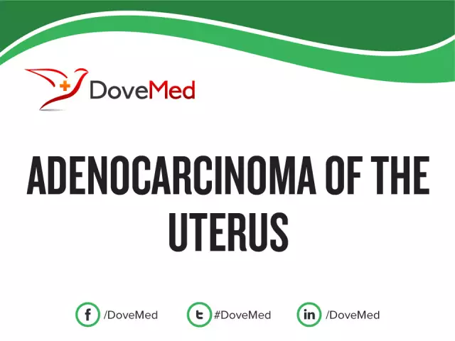 Adenocarcinoma Of The Stomach, Uterus, Rectum