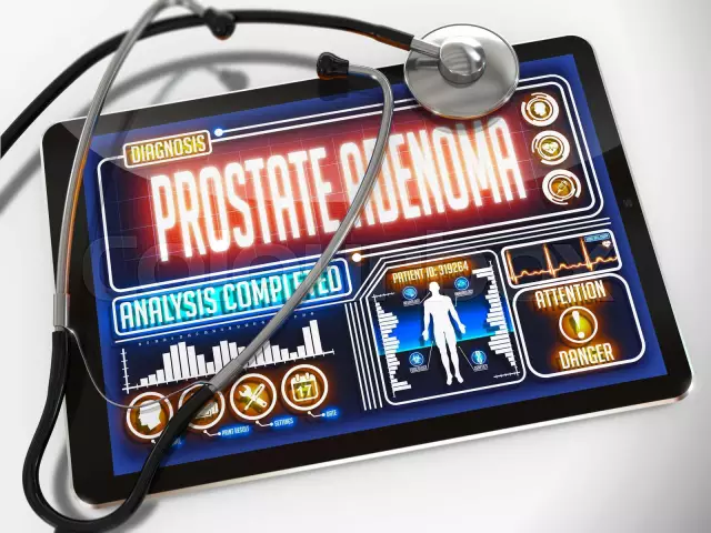 Prostate Adenoma Symptoms, Treatment, Surgery