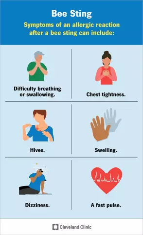 Anaphylaxis - Symptoms, Causes, Treatment