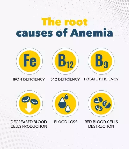 Anemia - Causes, Degrees, Symptoms, Treatment