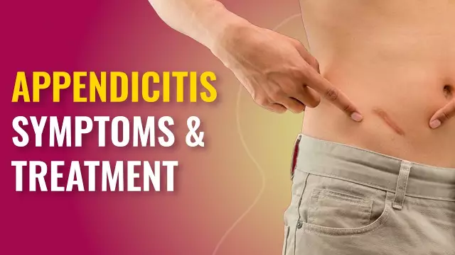 Appendicitis - Symptoms, Causes, Treatment, Removal