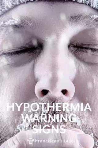 Hypothermia - Signs, Degrees, First Aid