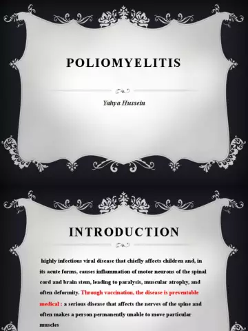 Poliomyelitis - Types, Symptoms, Treatment And Prevention