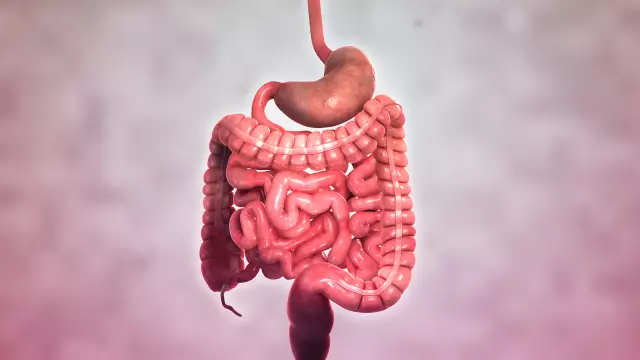 Crohn's Disease - Symptoms, Treatment, Causes