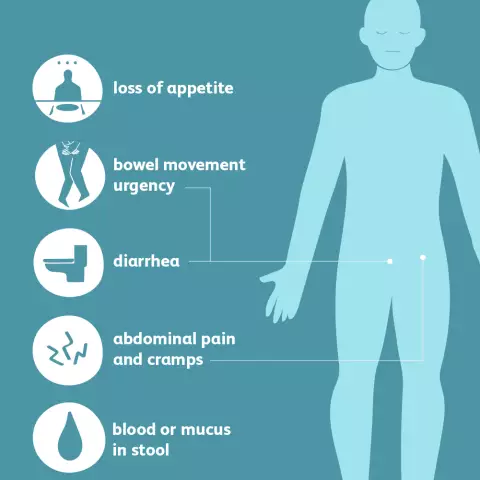 Ulcerative Colitis - Symptoms, Treatment