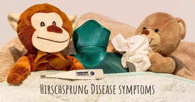 Hirschsprung's Disease - Symptoms, Treatment, Surgery