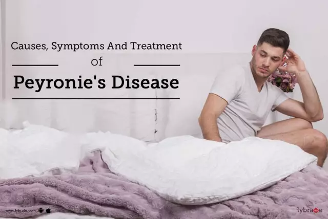 Peyronie's Disease - Causes, Symptoms, Treatment Methods, Surgery