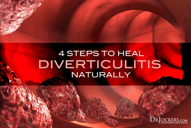 Diverticulosis - Treatment, Types, Symptoms