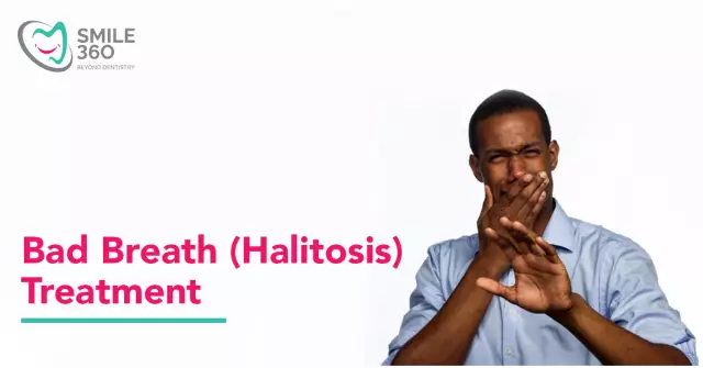 Halitosis - Causes, Symptoms, Diagnosis, Treatment Methods