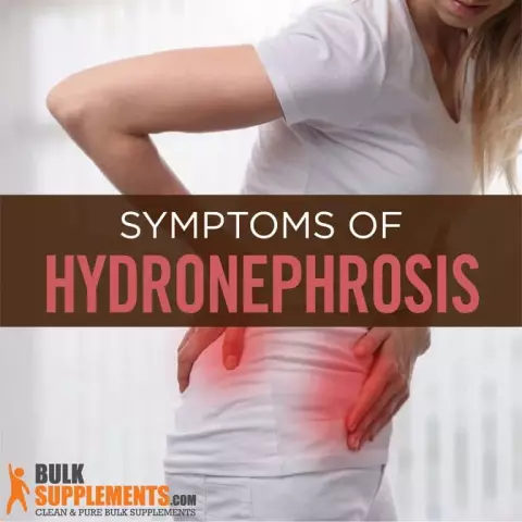 Hydronephrosis - Degrees, Symptoms, Treatment