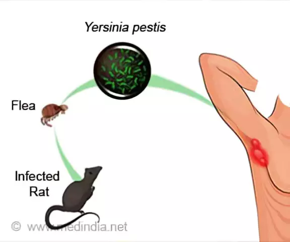 Yersiniosis - Treatment, Symptoms, Prevention