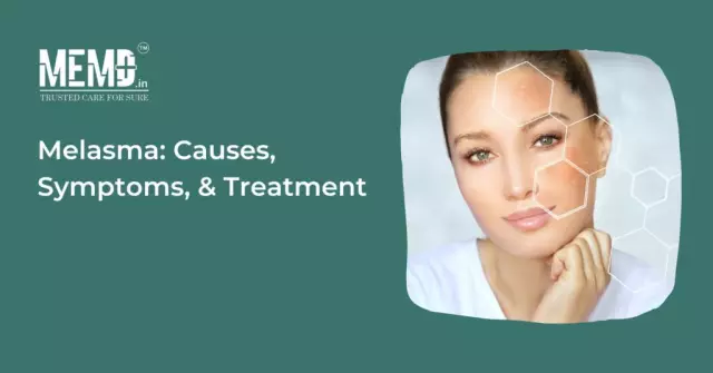 Melasma - Types, Causes, Treatment