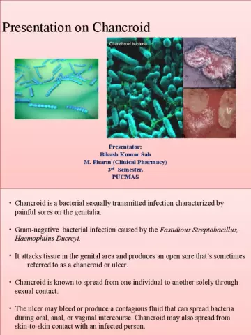 Chancroid - Causes, Symptoms, Treatment