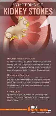 Kidney Stones - Treatment, Crushing, Symptoms