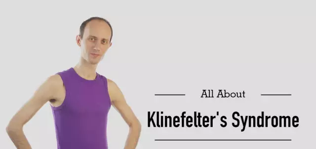 Klinefelter Syndrome - Symptoms, Diagnosis, Treatment