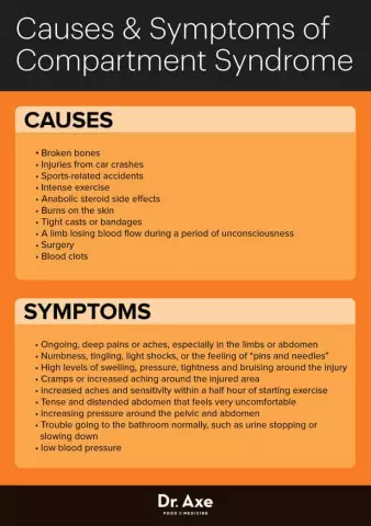 Radicular Syndrome - Causes, Symptoms, Treatment