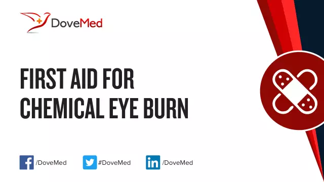 Eye Burn - First Aid, Treatment