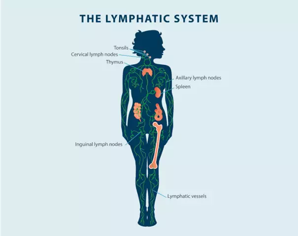 Lymphedema - Symptoms, Causes, Treatment