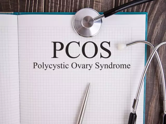 Polycystic Ovary