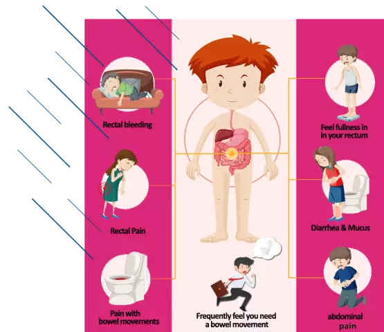 Rectal Proctitis - Symptoms, Treatment With Folk Remedies