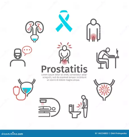 Prostatitis - Treatment, Symptoms, Causes