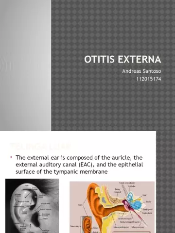 Otitis Externa - Symptoms, Types, Causes