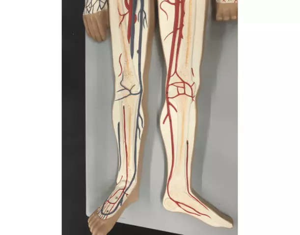 Circulatory Disorders Of The Lower Extremities - Treatment