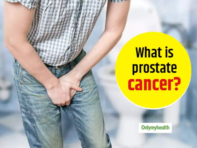 Prostate Cancer - Causes, Symptoms, Stages, Diagnosis, Treatment