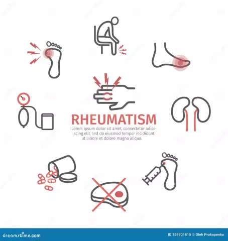 Rheumatism - Symptoms, Treatment