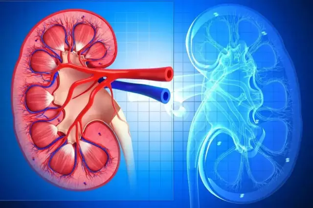 Chronic Nephritis - Treatment, Symptoms, Types