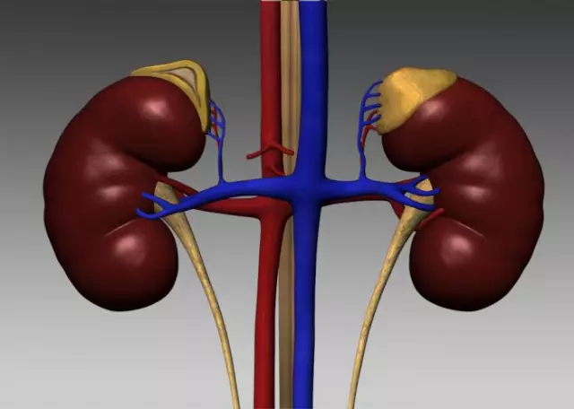 Pheochromocytoma - Symptoms, Diagnosis, Treatment