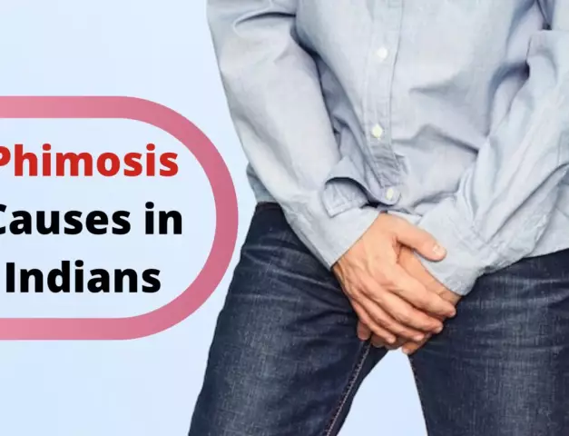 Phimosis - Types, Causes, Treatment