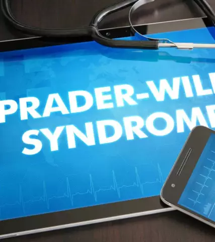 Prader-Willi Syndrome - Signs, Diagnosis, Treatment