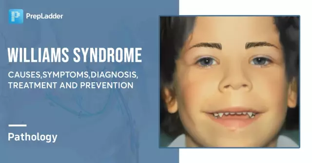 Reye's Syndrome - Symptoms, Diagnosis, Treatment, Prevention