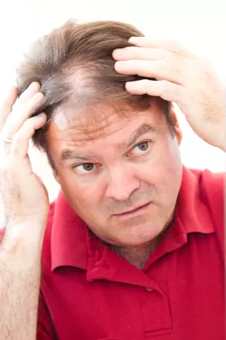 4 Ways To Wake Up Hair Follicles