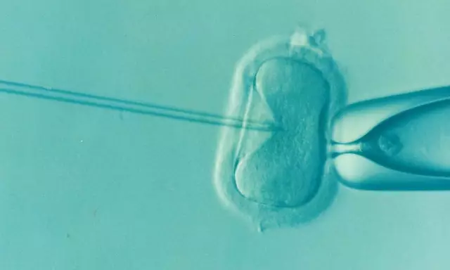 7 Interesting Facts About IVF