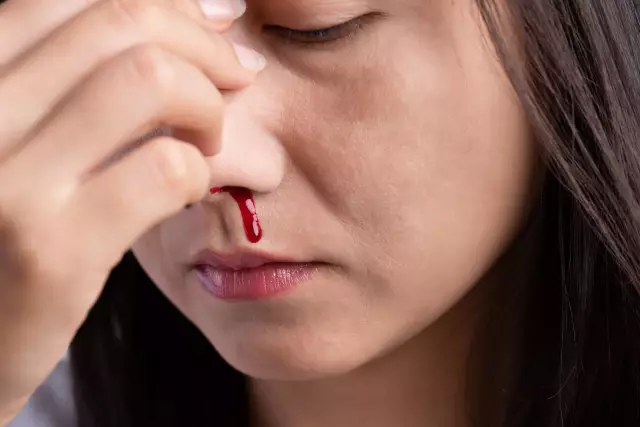 16 Causes Of Bleeding In The Eyes