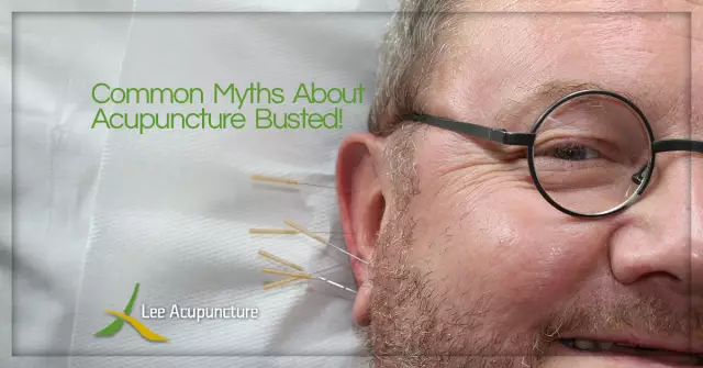 8 Myths About Acupuncture