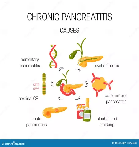 5 Misconceptions About Pancreatitis