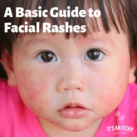 Health Problems And Related Facial Rashes