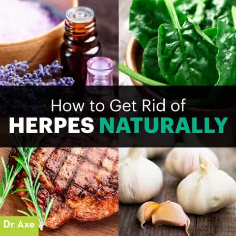 7 Folk Remedies To Get Rid Of Herpes On The Lips