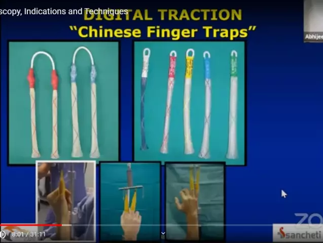 Arthroscopy Of The Joints - Features Of The Method, Indications, Advantages