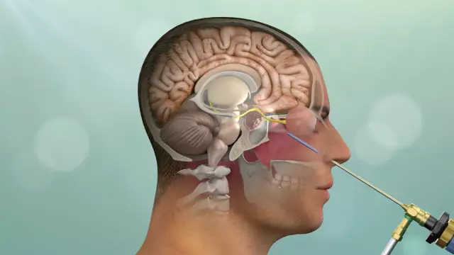 Effective Drugs And Medicines For The Treatment Of Prostate Adenoma Without Surgery