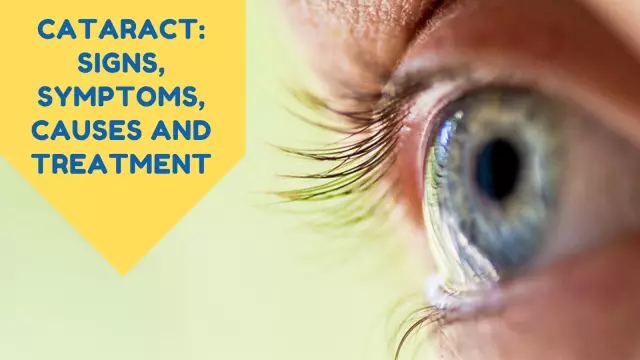 Cataract: Causes, Symptoms And Treatment Methods