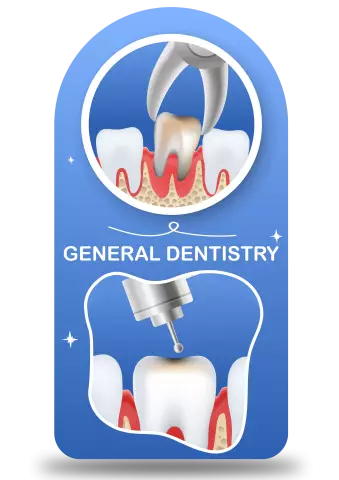 Installation Of Mouth Guards In Dentistry PROPRICUS